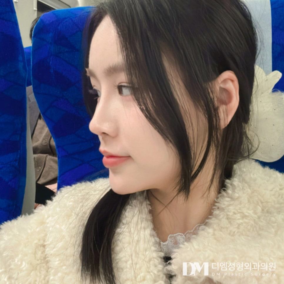 얼굴과 조화를 맞춘 오똑한 코 끝 만들기 관련 이미지 12