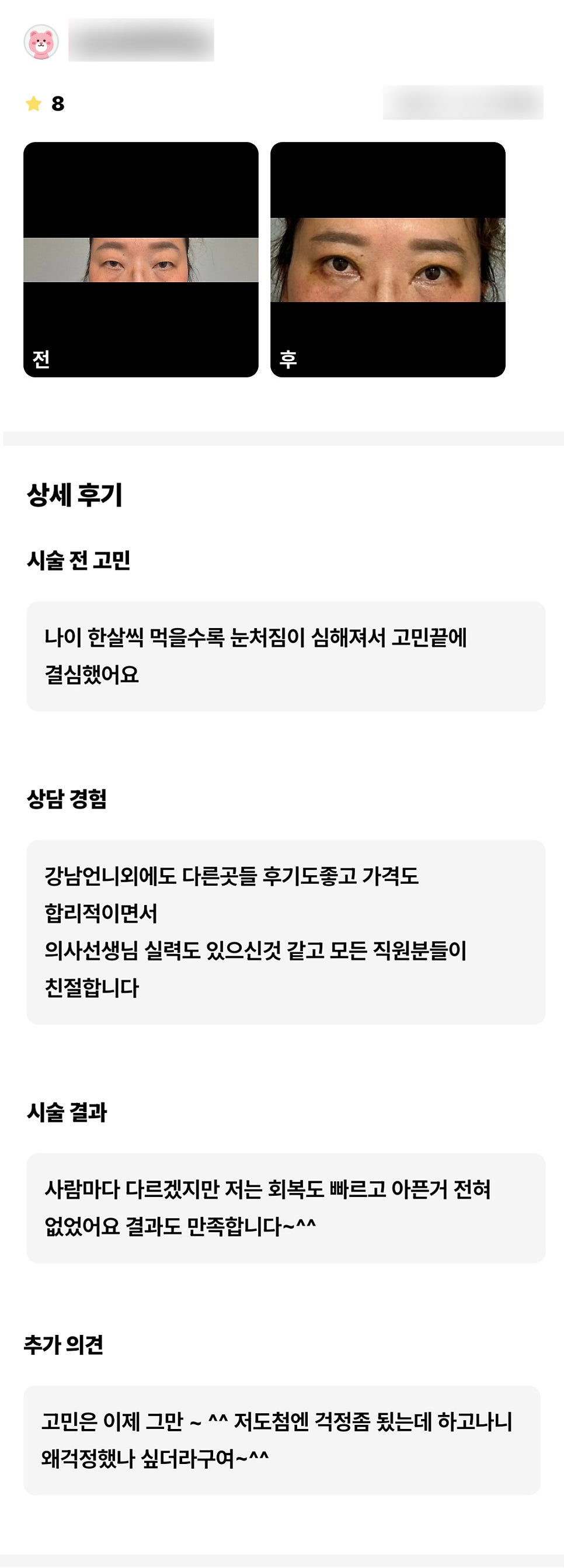 상안검 후기."저는 회복도 빠르고 아픈거 전혀 없었어요 결과도 만족합니다 ~^^" 관련 이미지 1