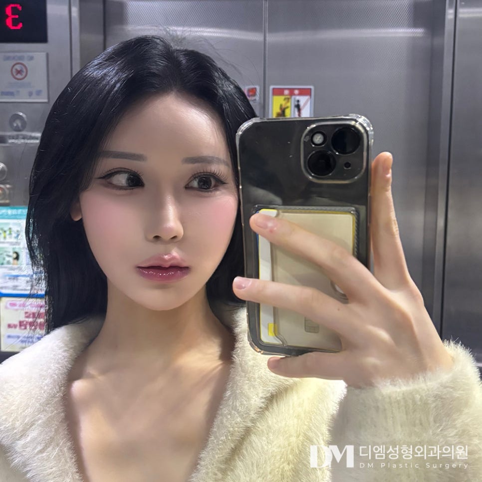 쌍꺼풀수술, 내 눈에도 봄이?! 관련 이미지 1