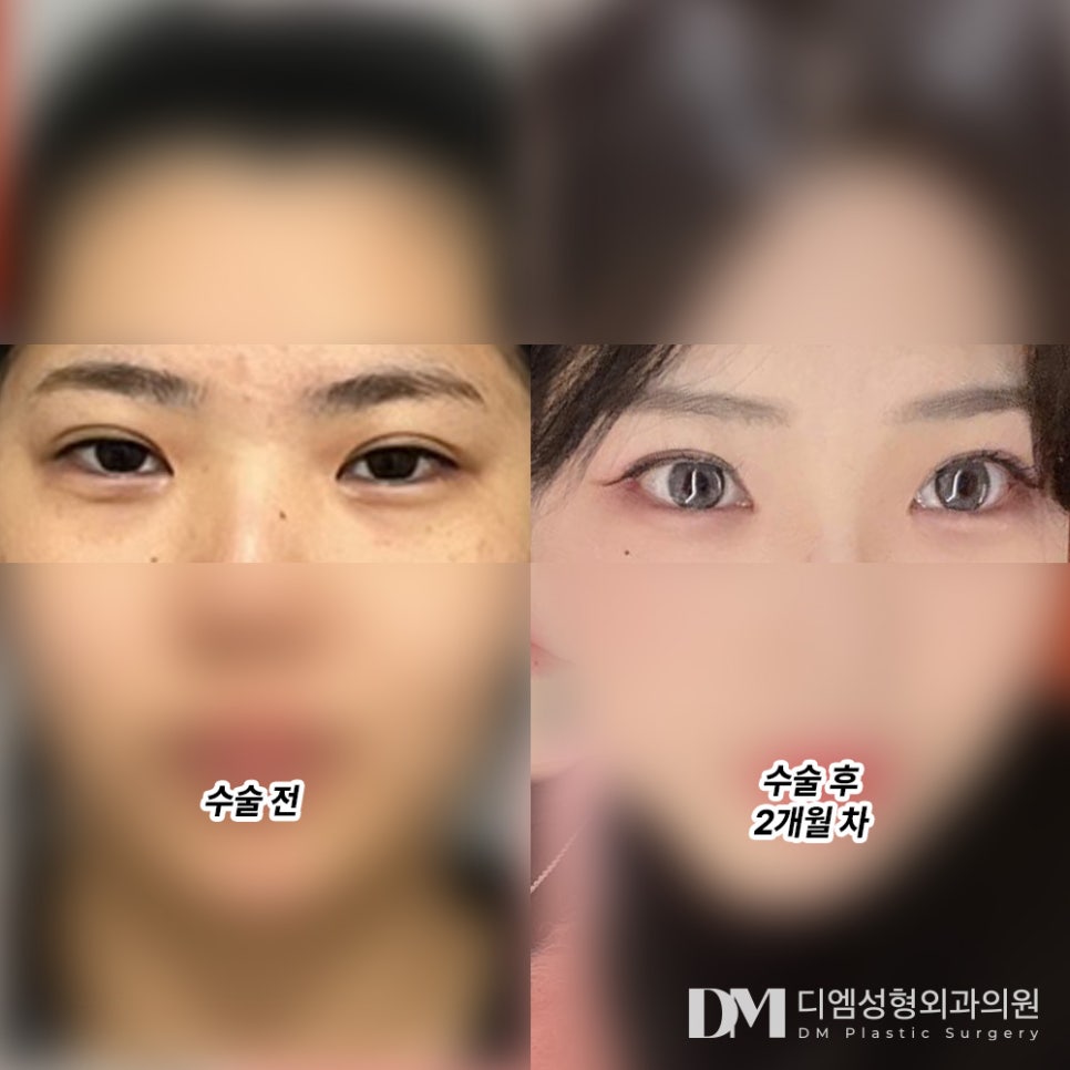 빵트임 후기."꼬막눈이신분들 강추드려용!!" 관련 이미지 2