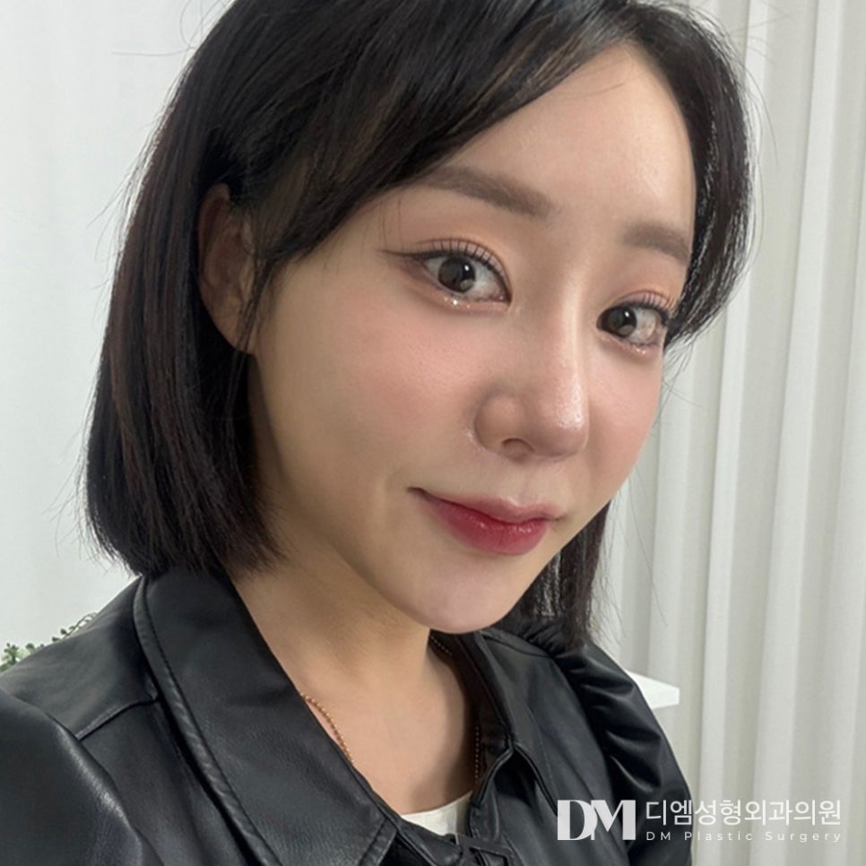 반거상, 흉터걱정은 덜고 리프팅 효과는 올리고! 관련 이미지 1