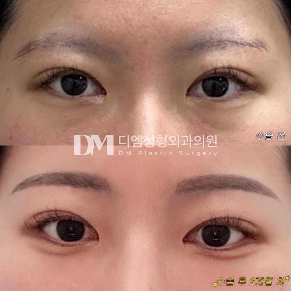 빵트임 후기."자연스럽게 최대한 트고 싶었어서 너무 만족합니다!" 관련 이미지 2