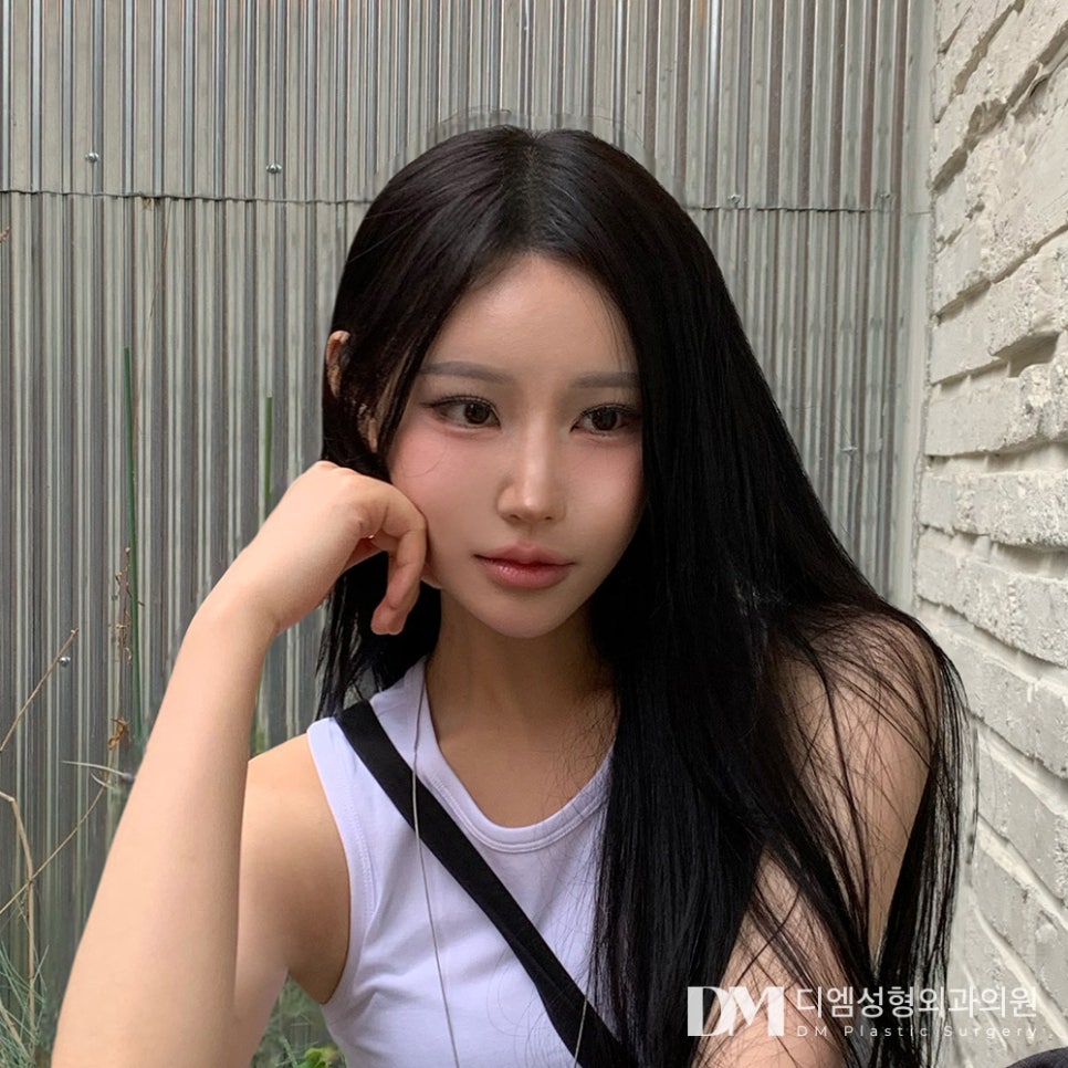 쌍꺼풀수술, 맞춤형 플랜으로 더욱 자연스럽게 관련 이미지 14