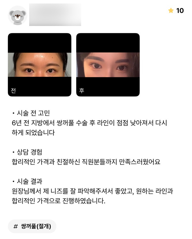 눈재수술 후기."원장님께서 제 니즈를 잘 파악해주셔서 좋았어요!" 관련 이미지 1