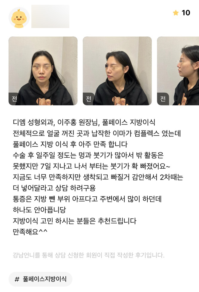 얼굴지방이식 후기."컴플렉스가 개선되어 아주 만족합니다!" 관련 이미지 1