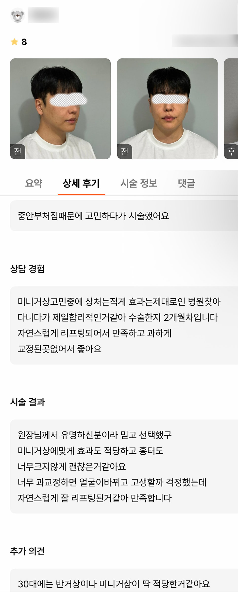 반거상 후기."자연스럽고 과한 부분이 없어서 좋아요!" 관련 이미지 1