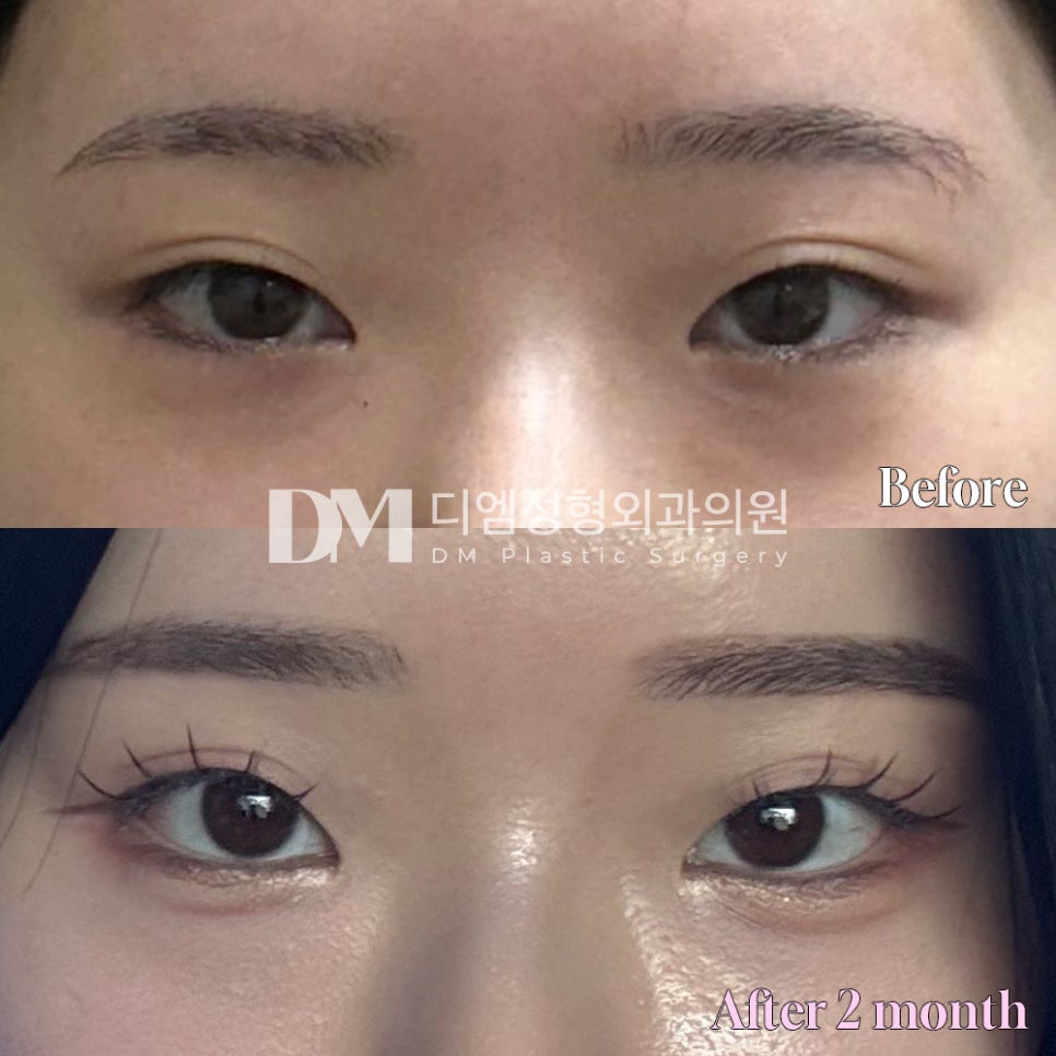 Bangtwin Review. "I really love that it made my impression softer!" image 2
