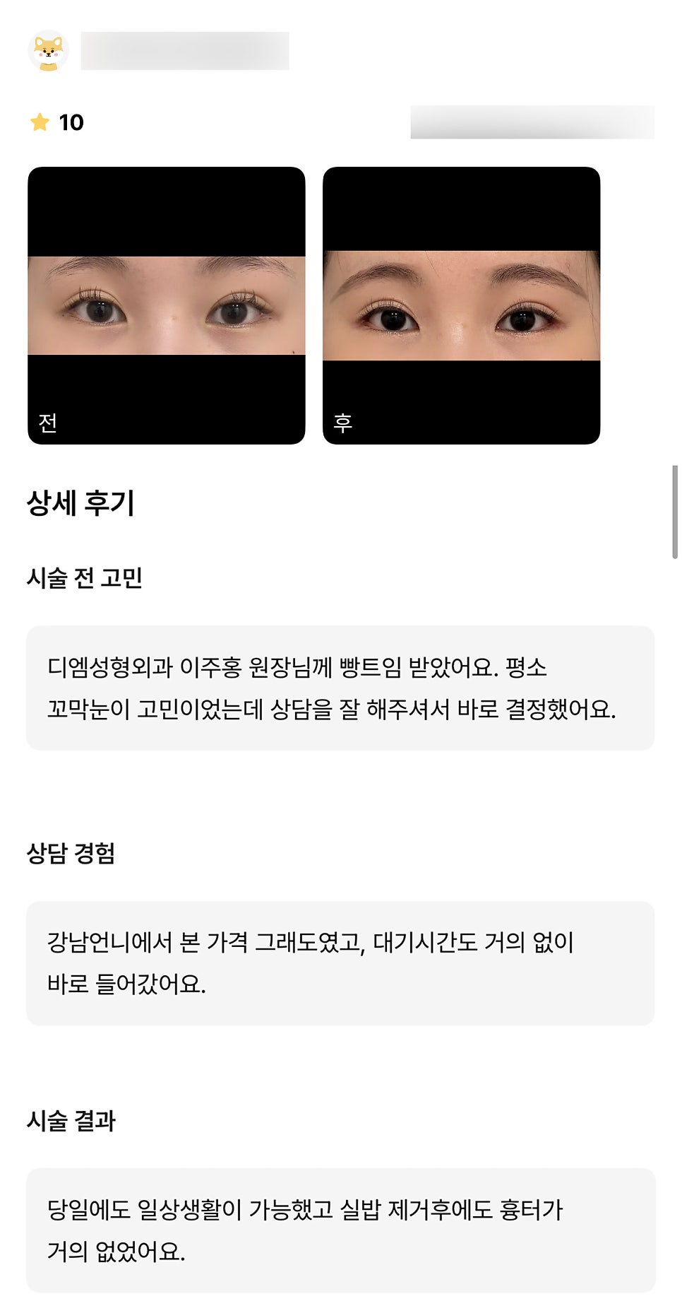 빵트임 후기."당일에도 일상 생활이 가능하고 흉터도 없어 좋았어요!" 관련 이미지 1