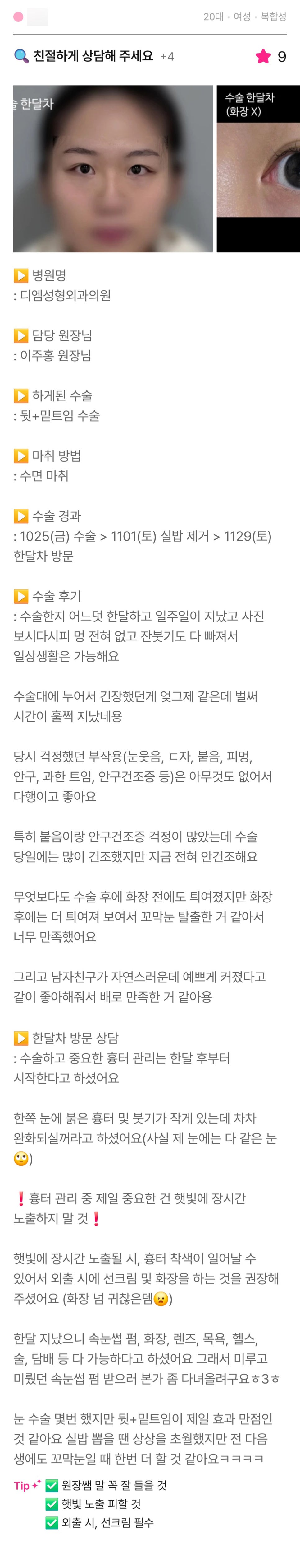 뒤밑트임 후기."꼬막눈 탈출한 거 같아서 너무 만족했어요!" 관련 이미지 1