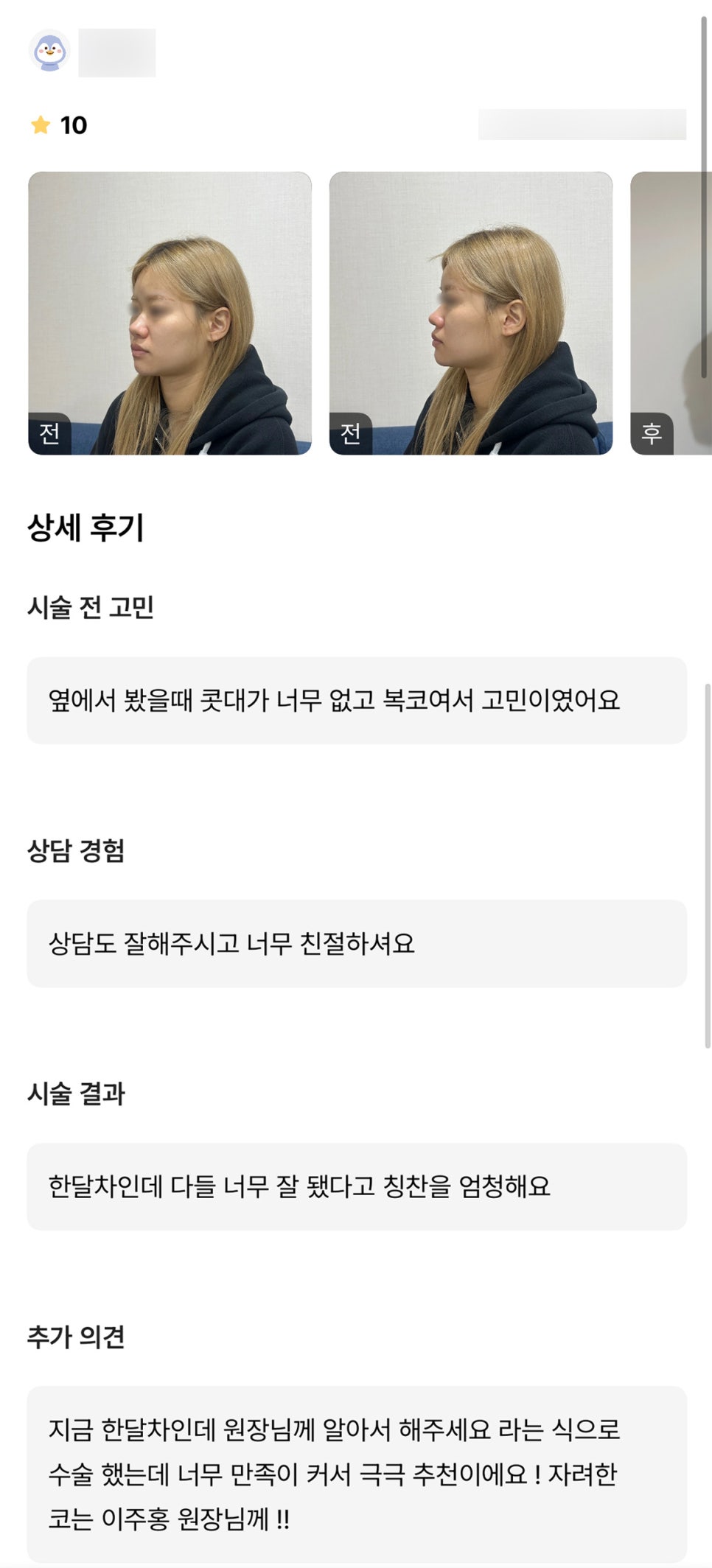 코성형 후기."너무 만족이 커서 극극 추천입니다 !" 관련 이미지 1