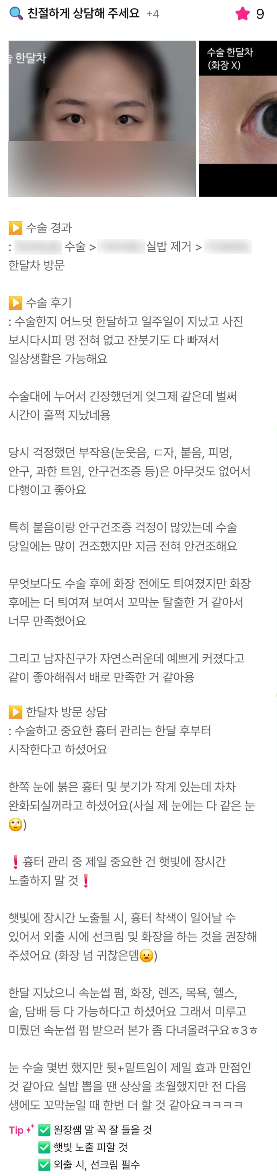 디엠 빵트임 수술후기, &ldquo;뒤밑트임이 제일 효과 만족인 것 같아요!&rdquo; 관련 이미지 1