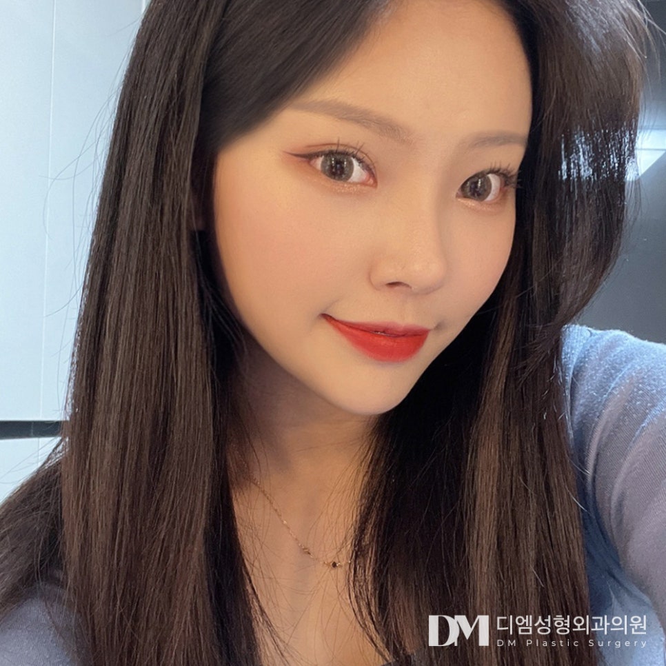뒤밑트임, 디엠만의 노하우로 자연스럽게 빵! 트인 눈매 관련 이미지 1