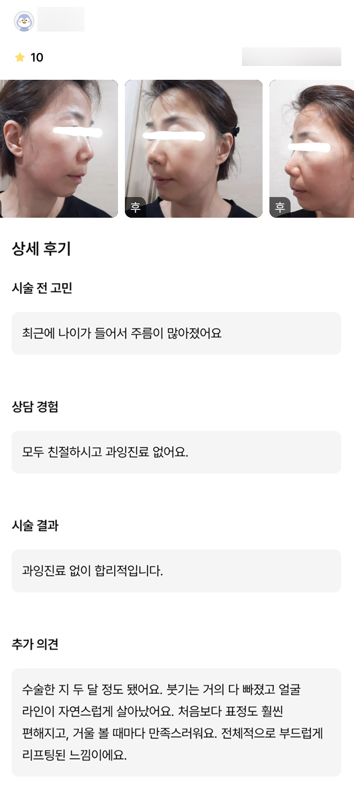 안면거상 후기."얼굴라인이 자연스럽게 살아나 거울 볼 때마다 만족스러워요!" 관련 이미지 1