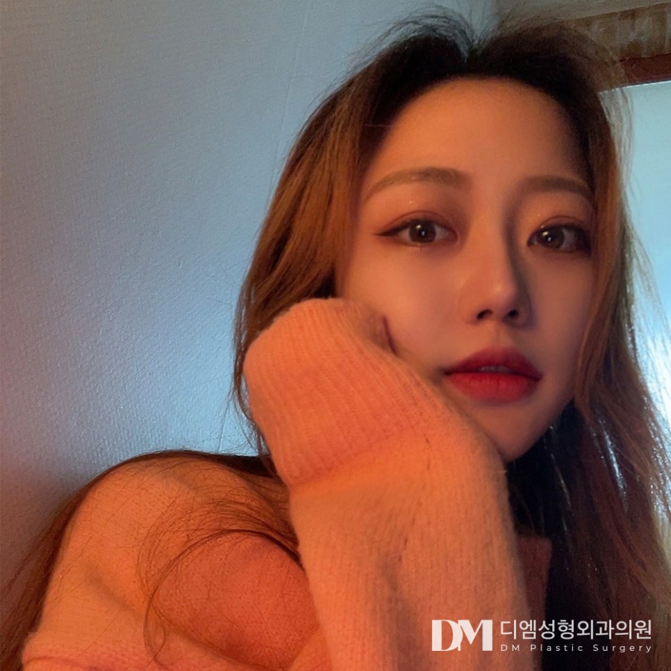 낮은코성형, 무조건 높은 코 보다는 내 이목구비에 맞게 ! 관련 이미지 12