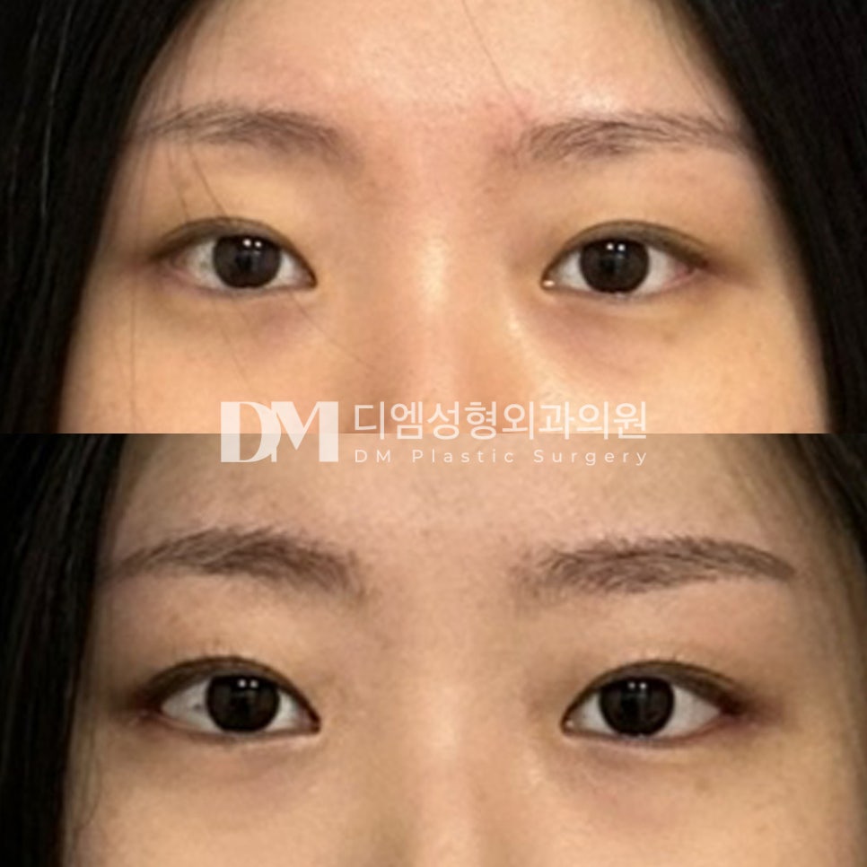 빵트임 후기."티 많이 안나는걸 원했어서 굉장히 만족중입니다!" 관련 이미지 2