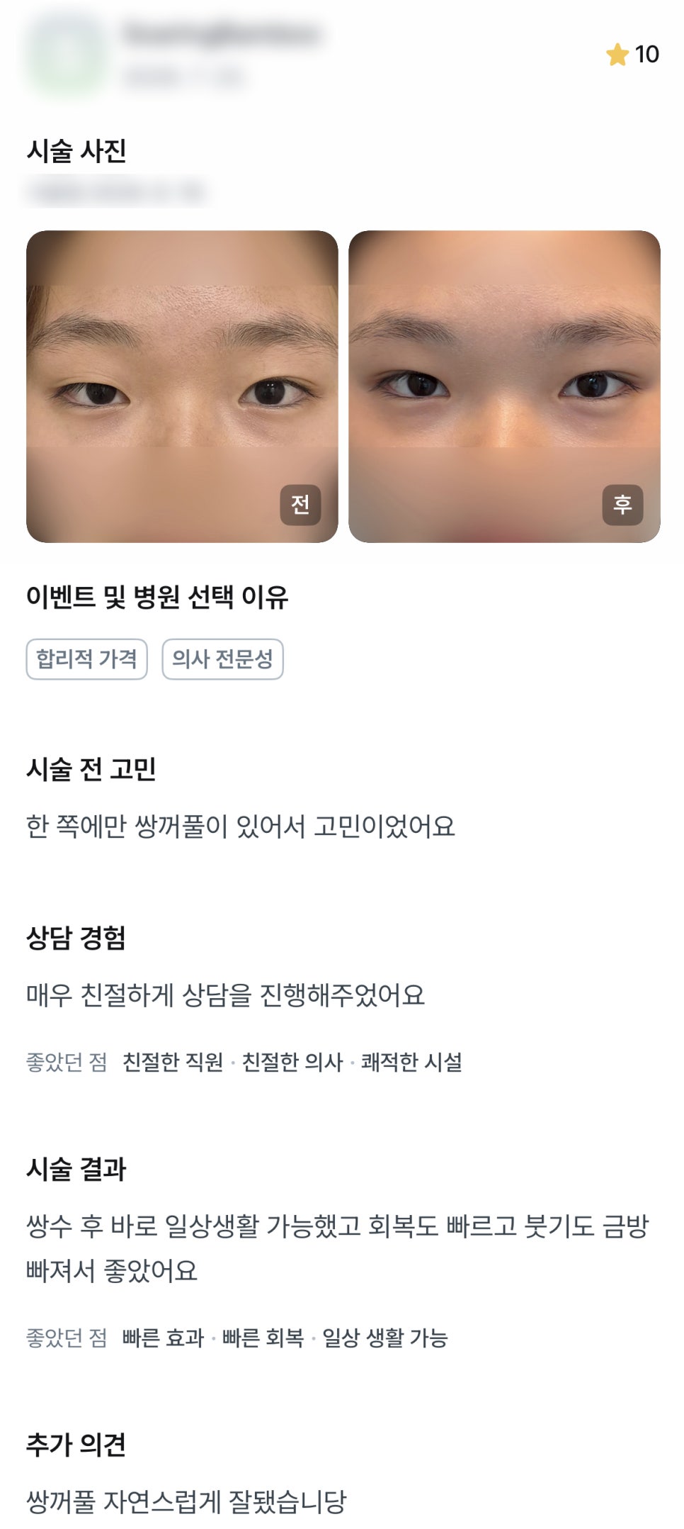 디엠 쌍꺼풀/눈성형 후기, &ldquo;쌍꺼풀 자연스럽게 잘됐습니다!&rdquo; 관련 이미지 1
