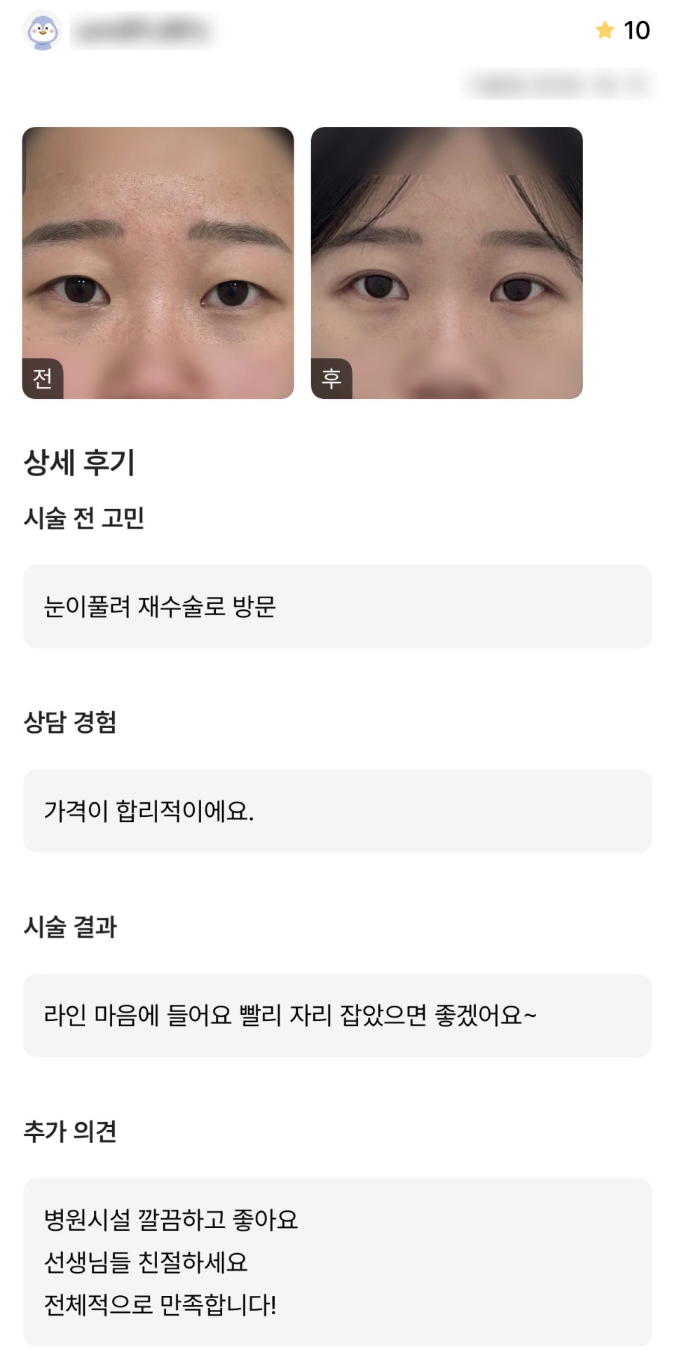디엠 눈재수술/빵트임 수술후기, &ldquo;가격이 합리적이고 라인이 마음에 들어요!&rdquo; 관련 이미지 1