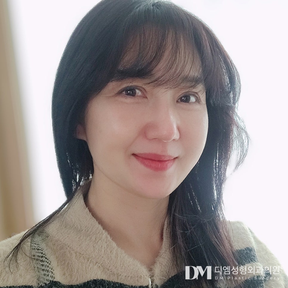 디엠 안면거상 전후사진, 얼굴 처짐과 턱선 무너짐 되살릴 수 있을까? 관련 이미지 3