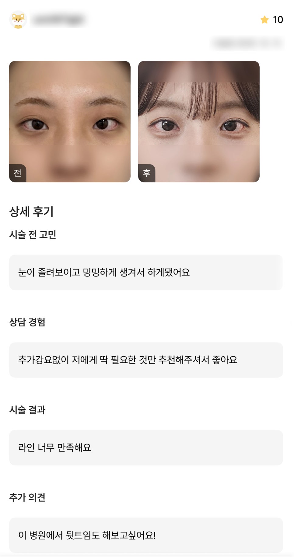 DM Eye Correction/Epicanthoplasty Surgery Review, “I’m So Satisfied with the Line!” image 1