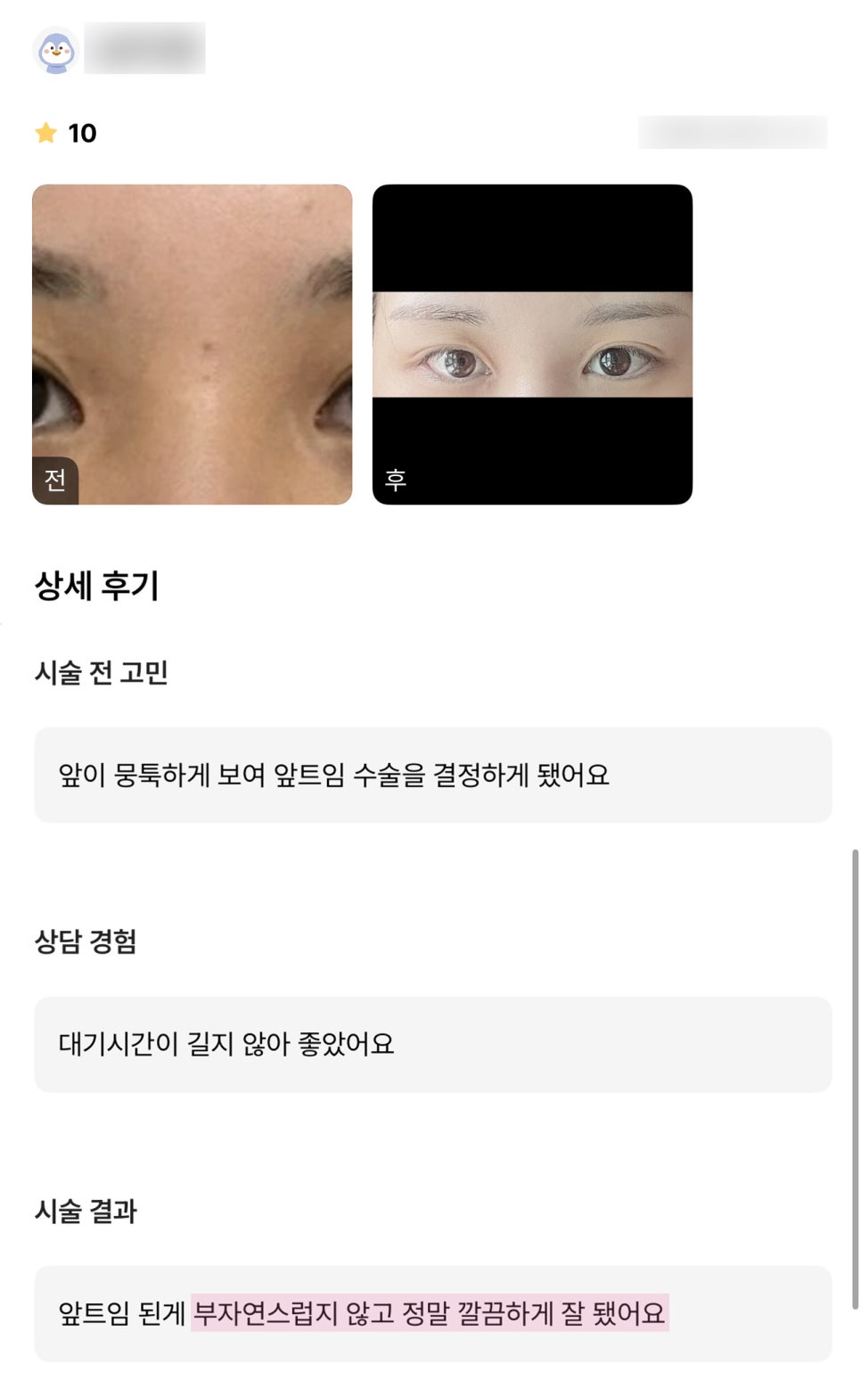 앞트임 후기."부자연스럽지 않고 정말 깔끔하게 잘 됐어요!" 관련 이미지 1