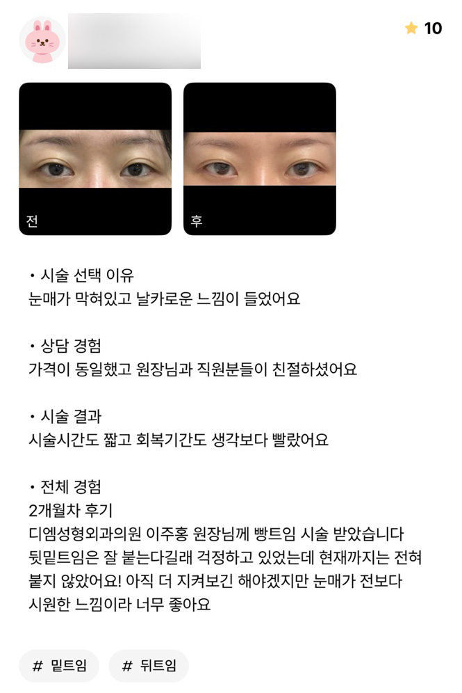 빵트임 후기."눈매가 전보다 시원한 느낌이라 너무 좋아요 ! " 관련 이미지 1