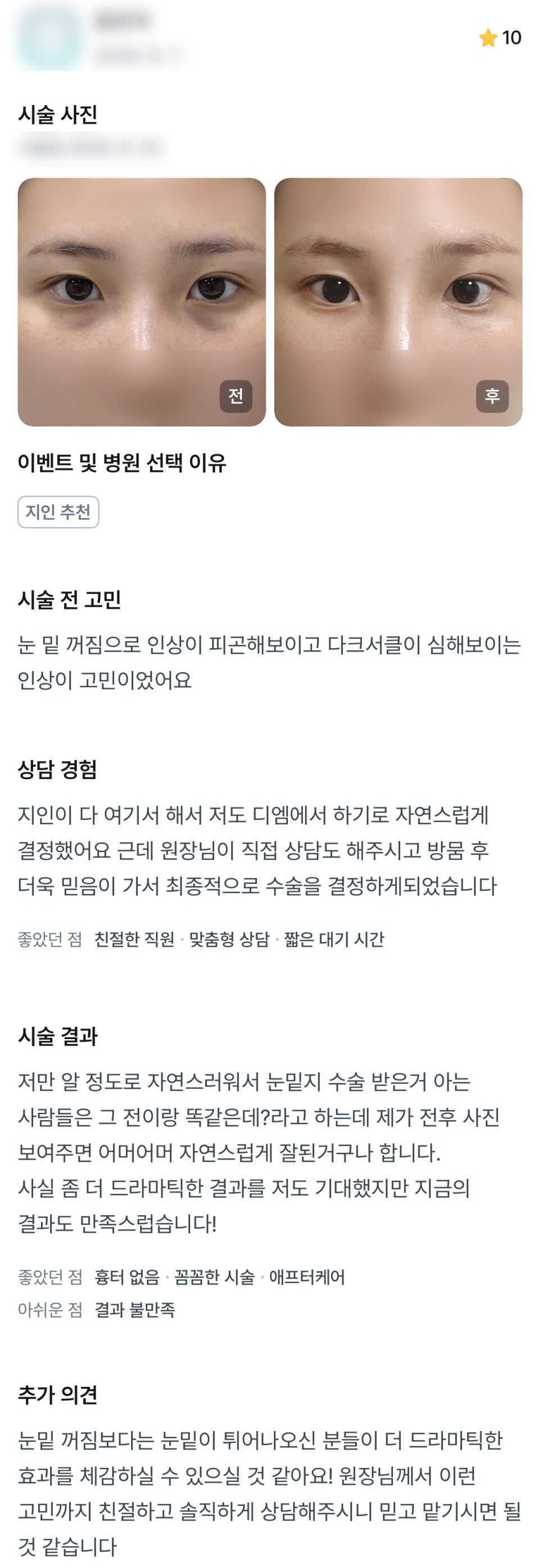 디엠 눈밑지방재배치/눈밑지방이식 수술후기, &ldquo;자연스럽게 되어서 만족스럽습니다!&rdquo; 관련 이미지 1