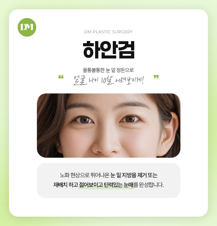 하안검, 밝고 젊어보이는 인상 만들기 관련 이미지 2