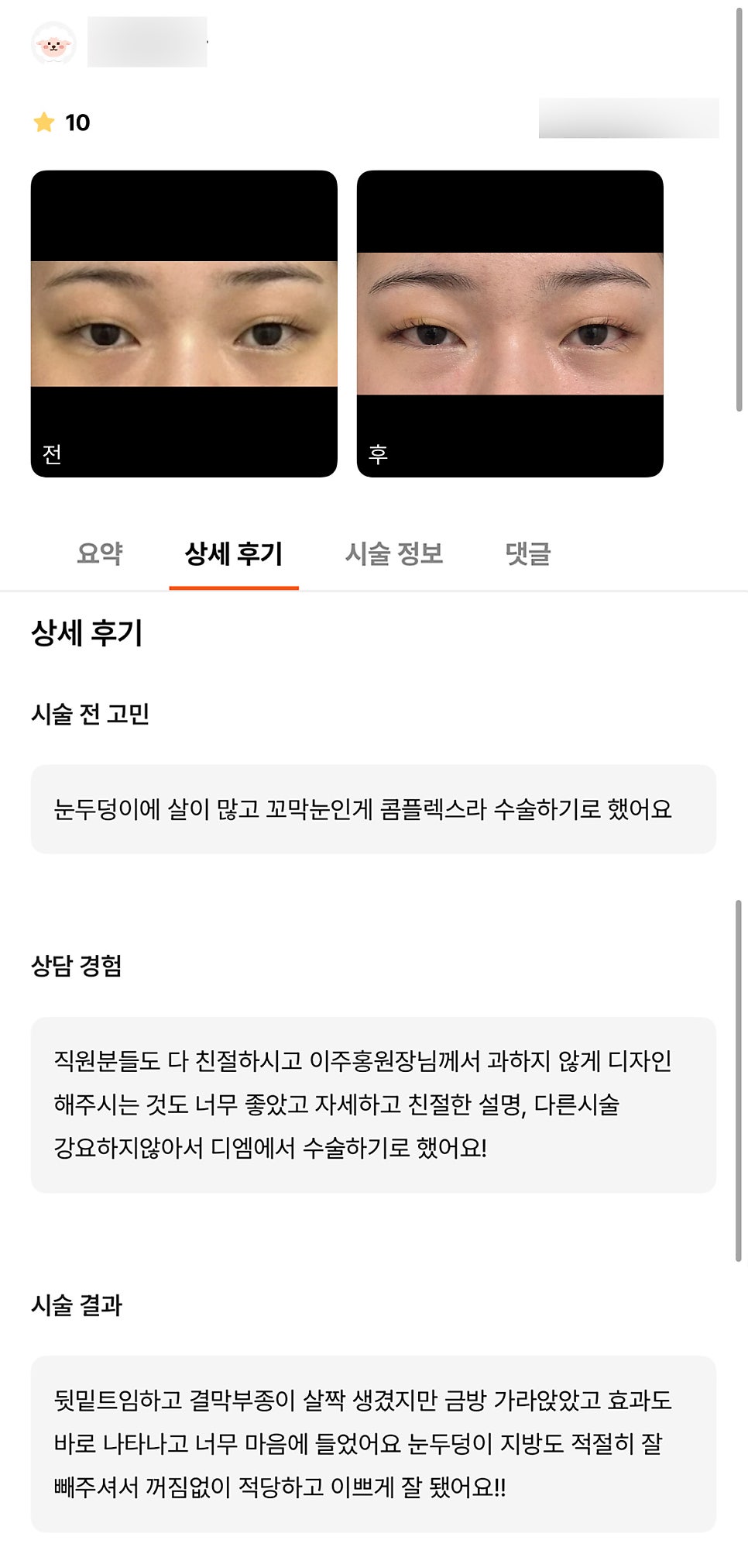 Bbangtwiem Review. "The effects showed right away, and I really liked it!" image 1