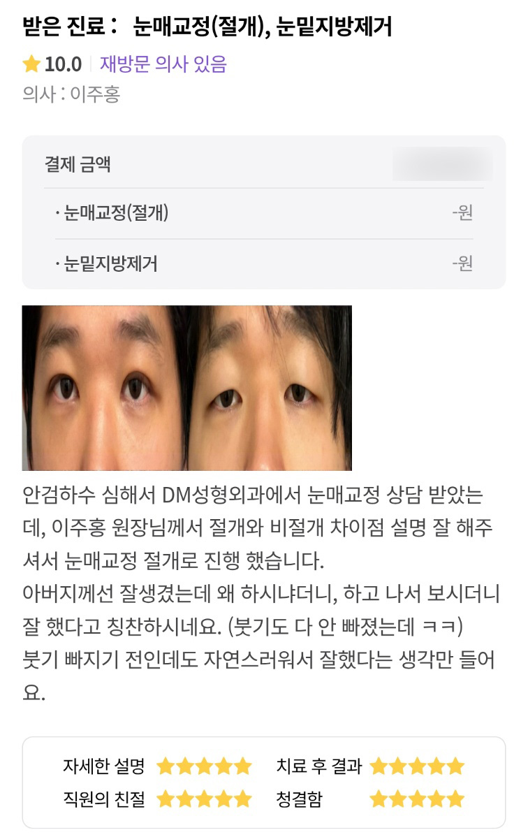 Eye Plastic Surgery Review: “Even before the swelling has gone down, it looks so natural that I can only think I made the right decision!” image 1