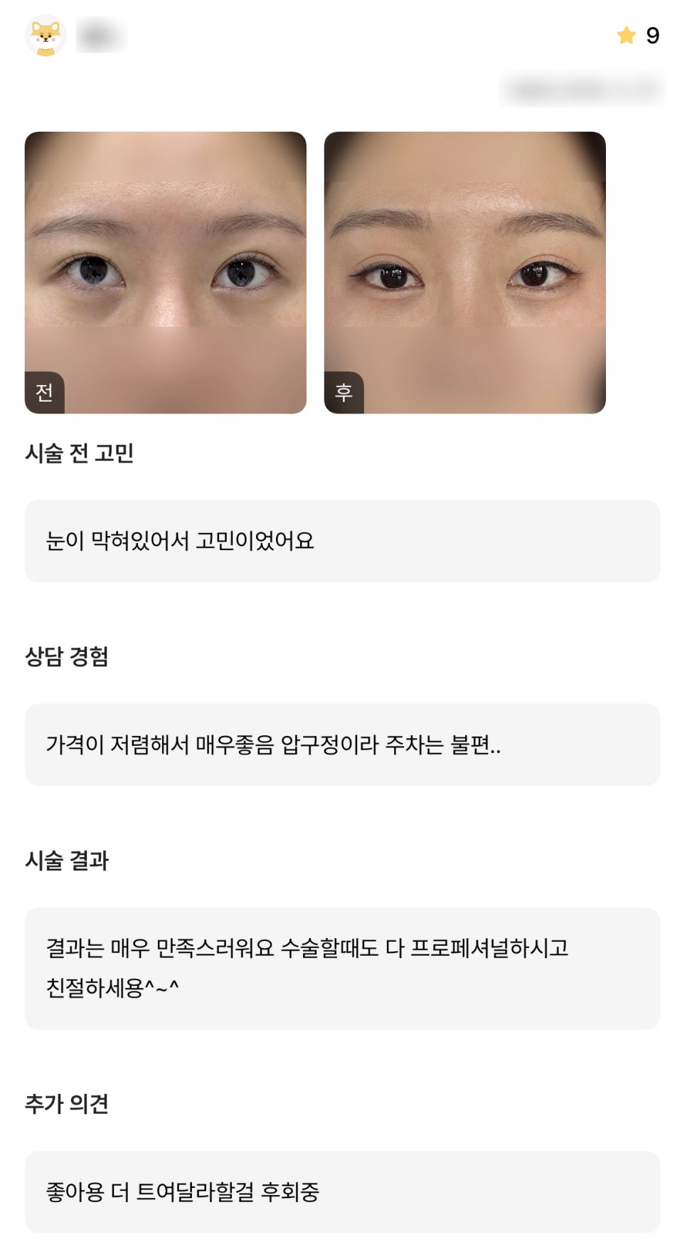 디엠 빵트임 수술후기, &ldquo;결과는 매우 만족스러워요!&rdquo; 관련 이미지 1