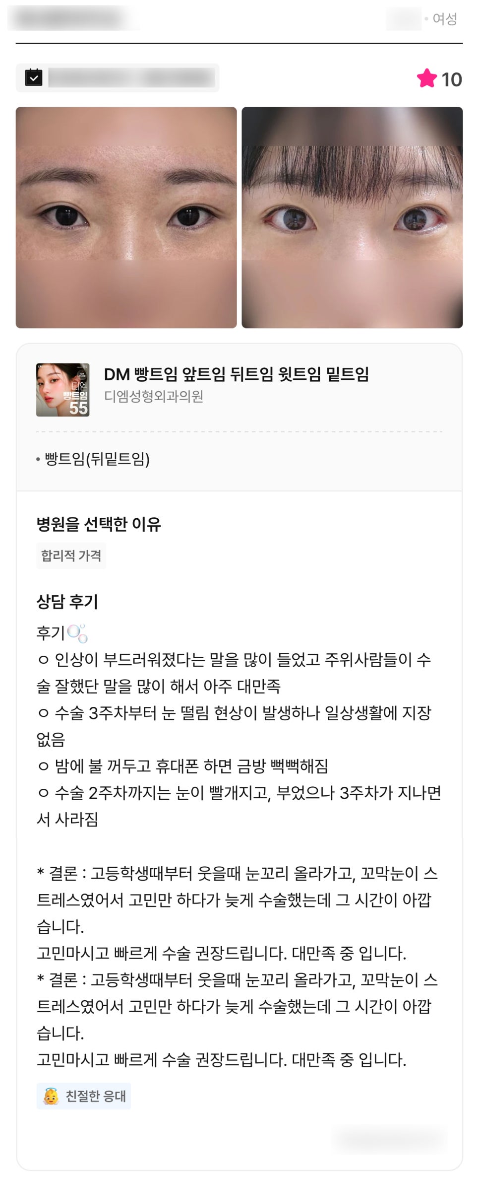 디엠 빵트임/뒤밑트임 후기, “대만족이에요! 고민했던 시간이 아깝습니다!” 관련 이미지 1