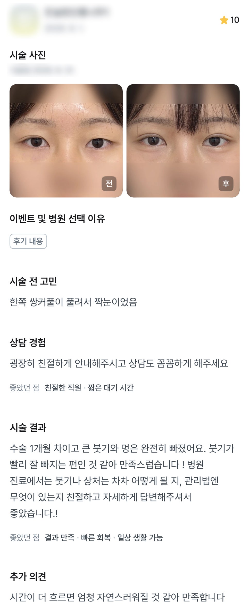 디엠 눈재수술/눈매교정 수술후기, “꼼꼼하고 친절하게 답변해주셔서 좋았어요!” 관련 이미지 1