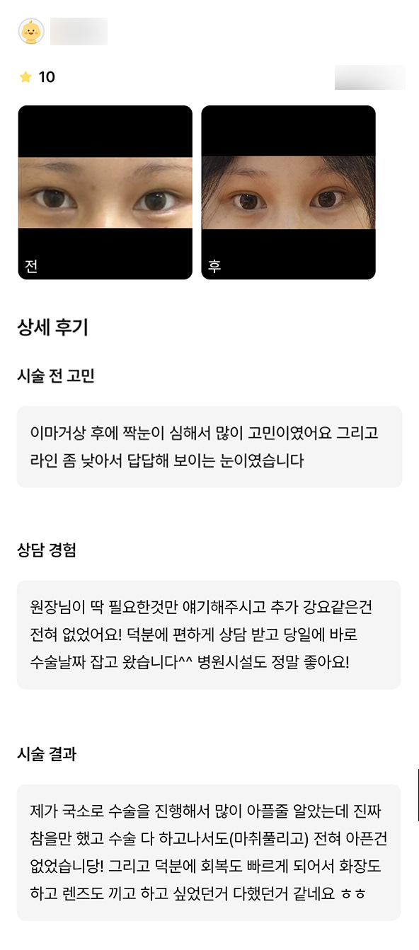 눈재수술 후기."수술 전혀 아프지도 않고 회복도 빨라서 좋았어요!" 관련 이미지 1