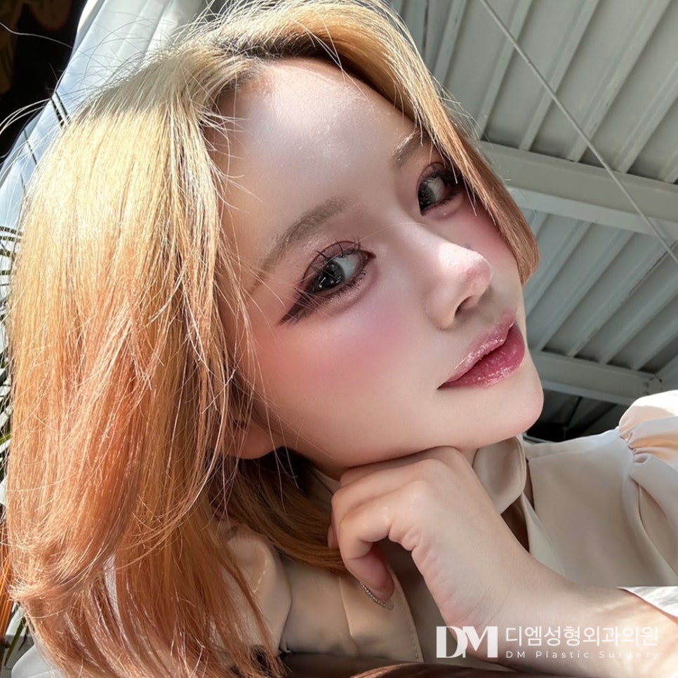 쌍꺼풀수술로 가볍고 또렷한 눈매 만들기 관련 이미지 14