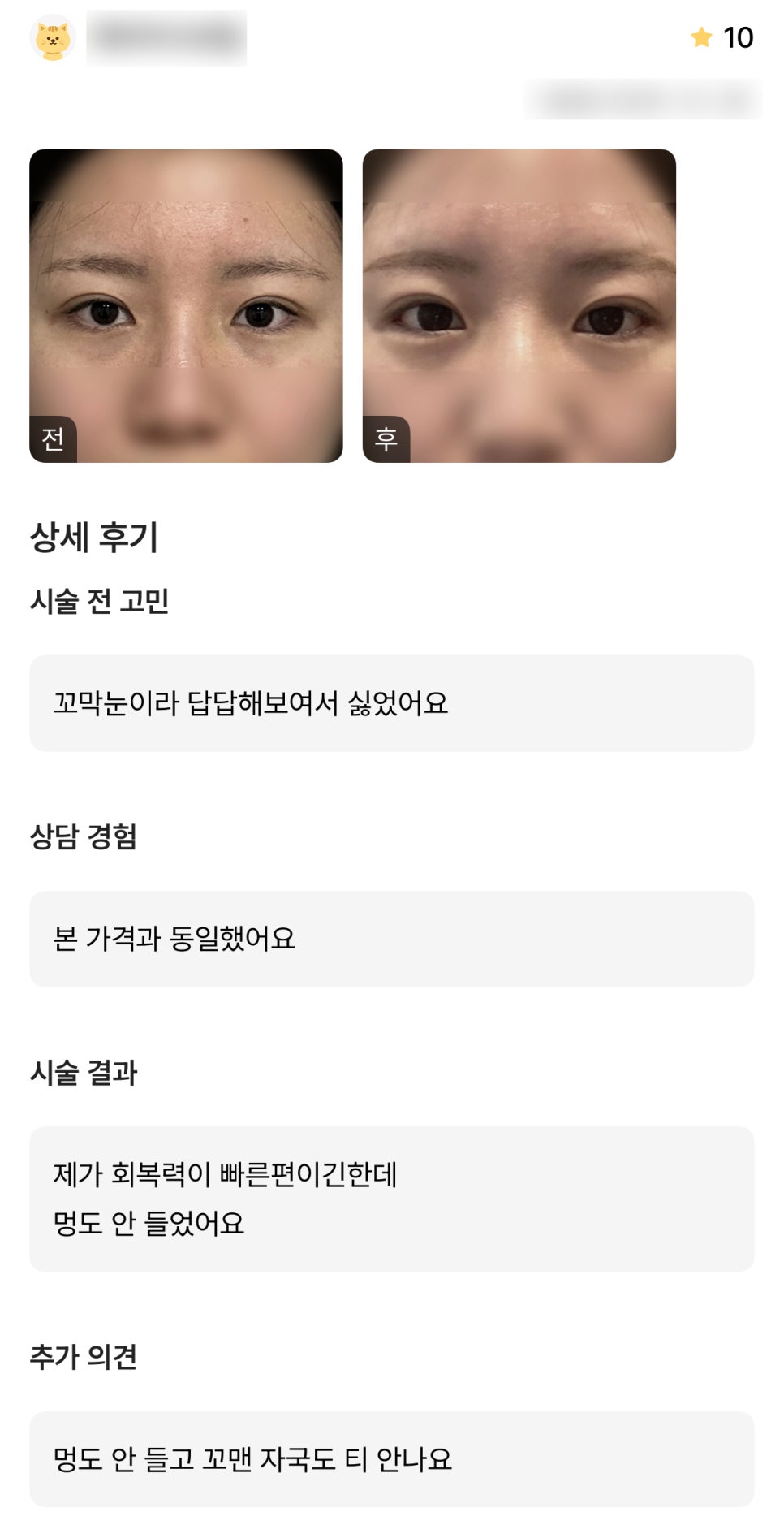 디엠 빵트임 수술후기, “멍도 안 들고 꼬맨 자국 티 안 나요!” 관련 이미지 1