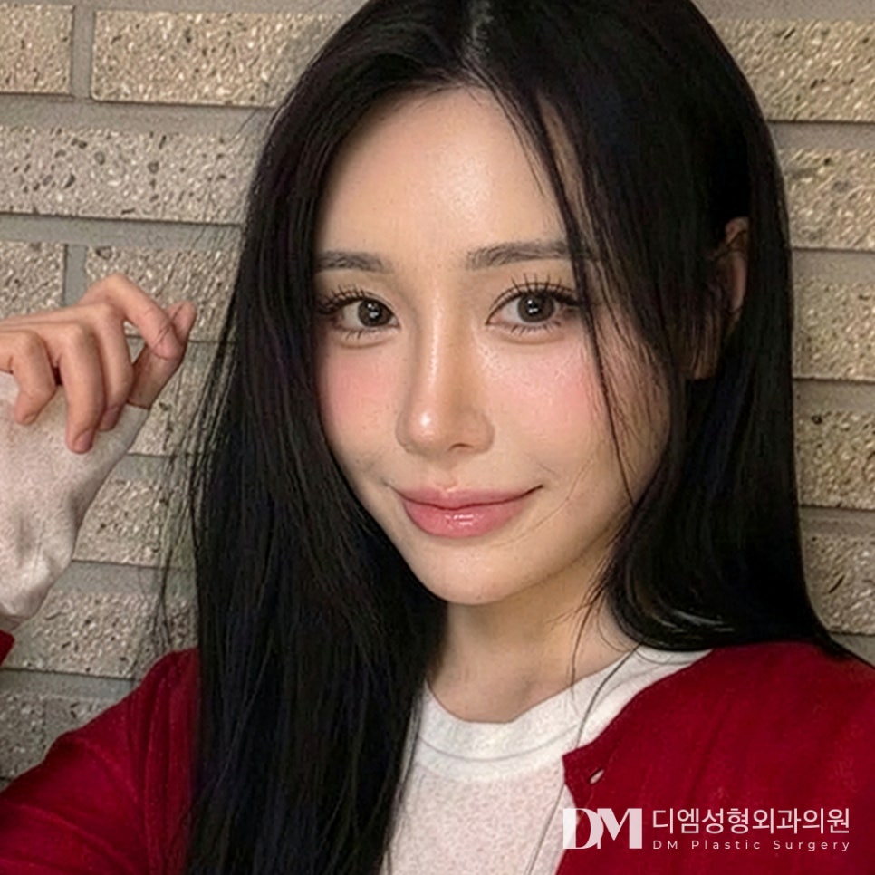 디엠 얼굴지방이식 전후사진, 자연스러운 불륨감과 입체감으로 고민 끝! 관련 이미지 1