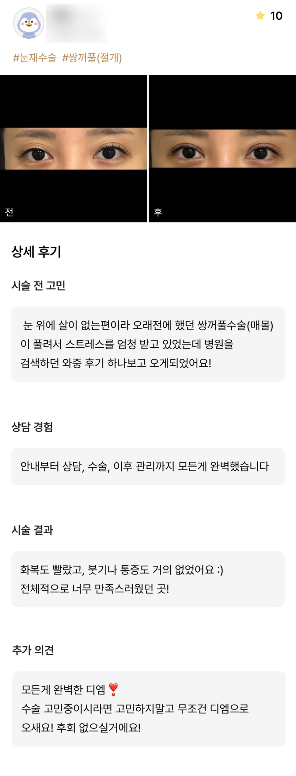눈재수술 후기."전체적으로 너무 만족스러워요!" 관련 이미지 1