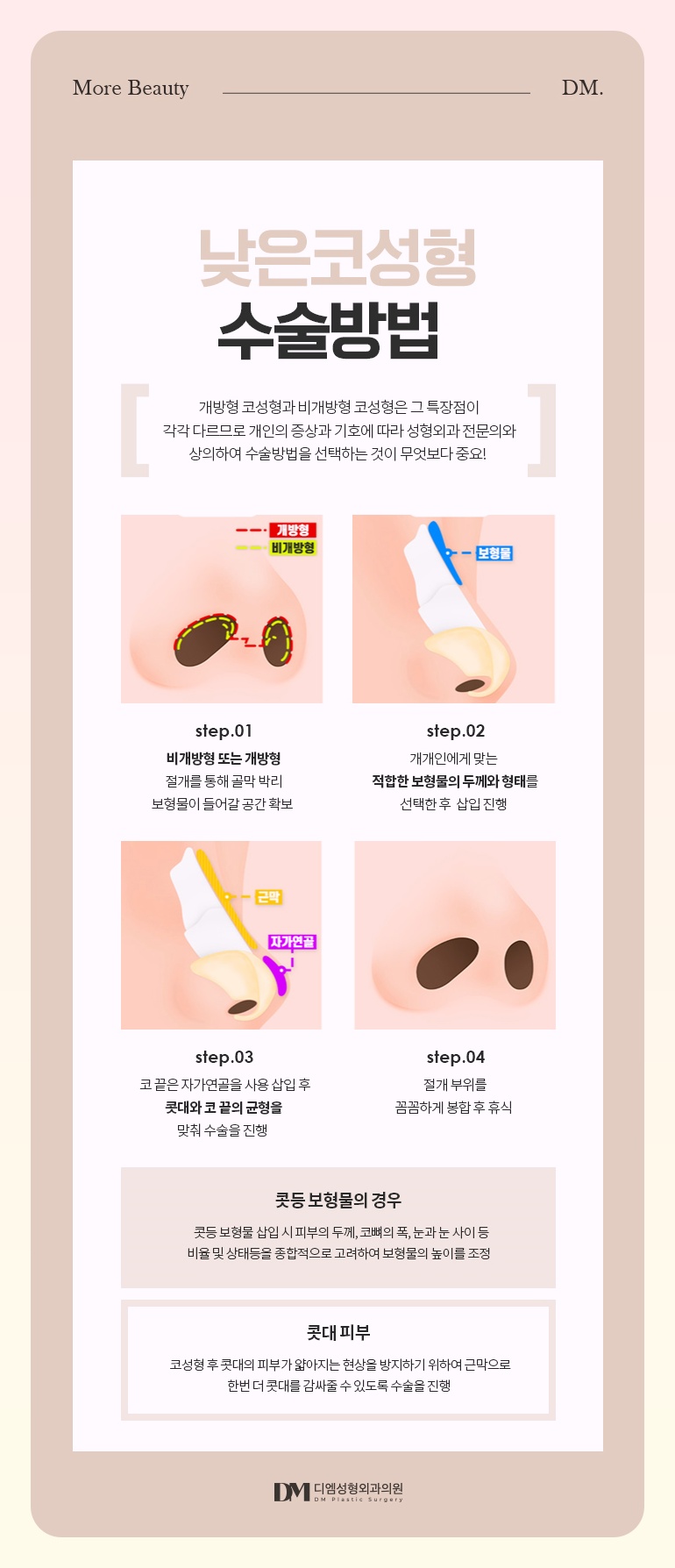 낮은코성형, 쉐딩 메이크업 탈출하자! 관련 이미지 6
