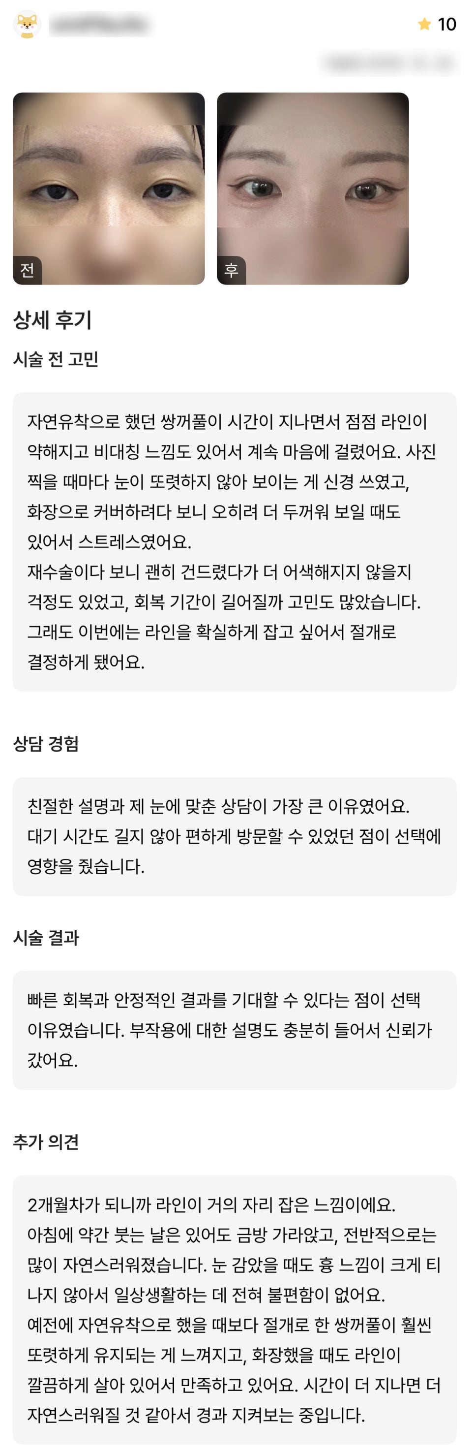 DM Revision Double Eyelid Surgery Review, “I’m satisfied because the line looks clean and well-defined!” image 1