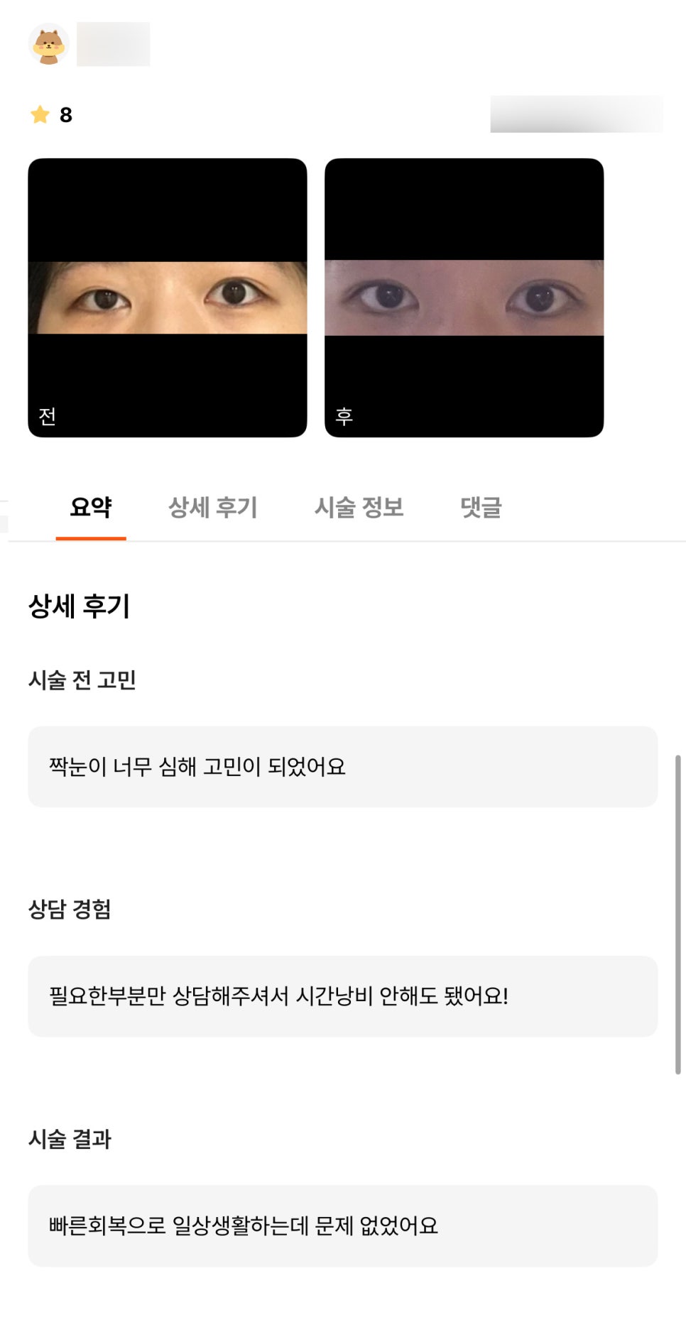 눈재수술 후기."빠른 회복으로 일상생활에 문제 없었어요!" 관련 이미지 1