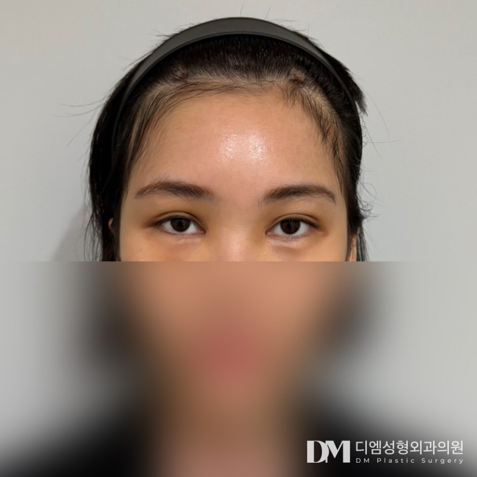 이마거상, 20대부터 60대까지 ! 관련 이미지 8