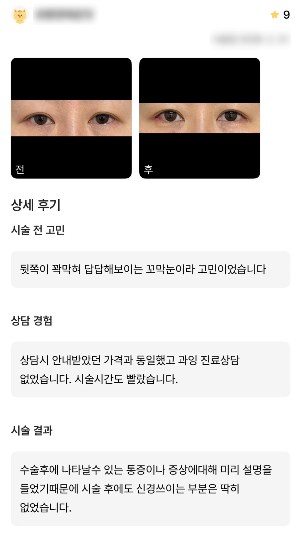 디엠 뒤밑트임 수술후기, &ldquo;과잉 진료 없었고 시술 후에도 신경 쓰이는 부분 없었습니다!&rdquo; 관련 이미지 1