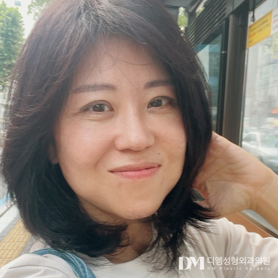 시야를 방해하는 처진 눈두덩이가 고민이라면? 관련 이미지 1