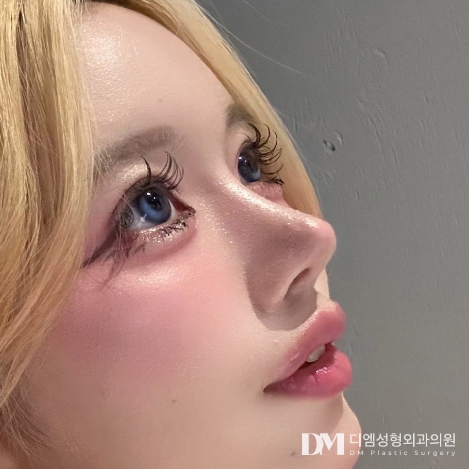 쌍꺼풀수술, 개인별 매력을 살려 관련 이미지 14