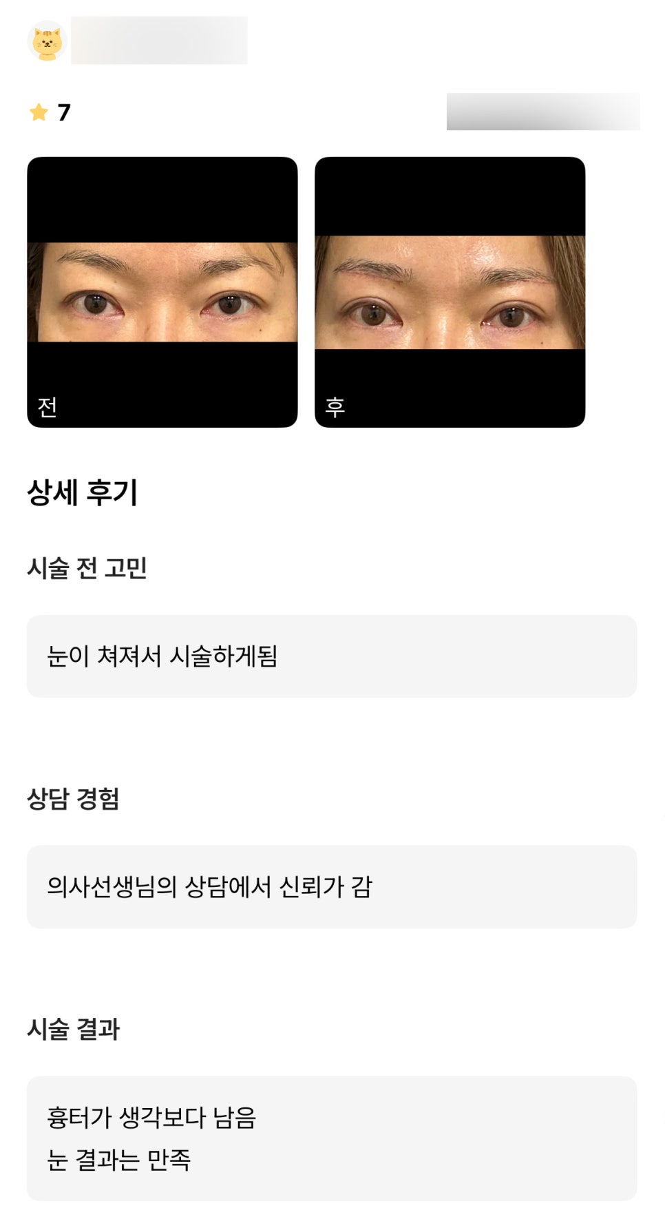 눈썹 하거상 후기."의사선생님도 신뢰가 가고 결과도 만족스러워요!" 관련 이미지 1