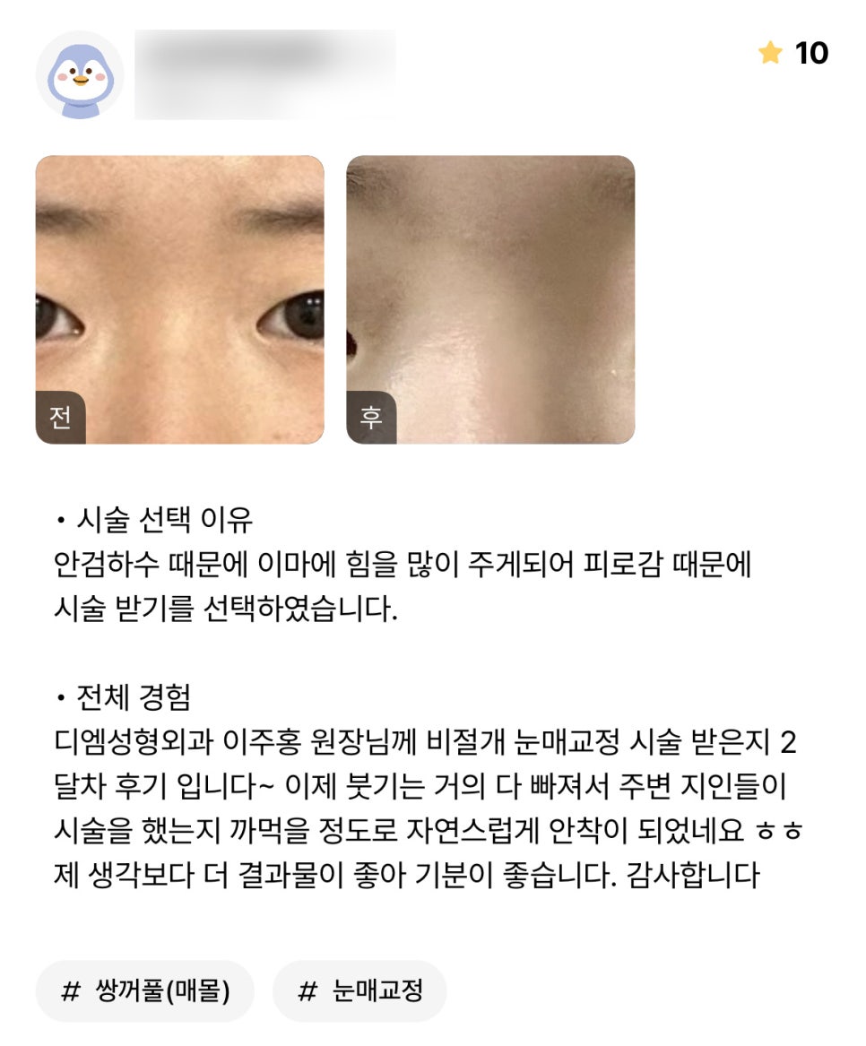 Eye Surgery Review. “I’m happy that the result is even better than I expected. Thank you.” image 1