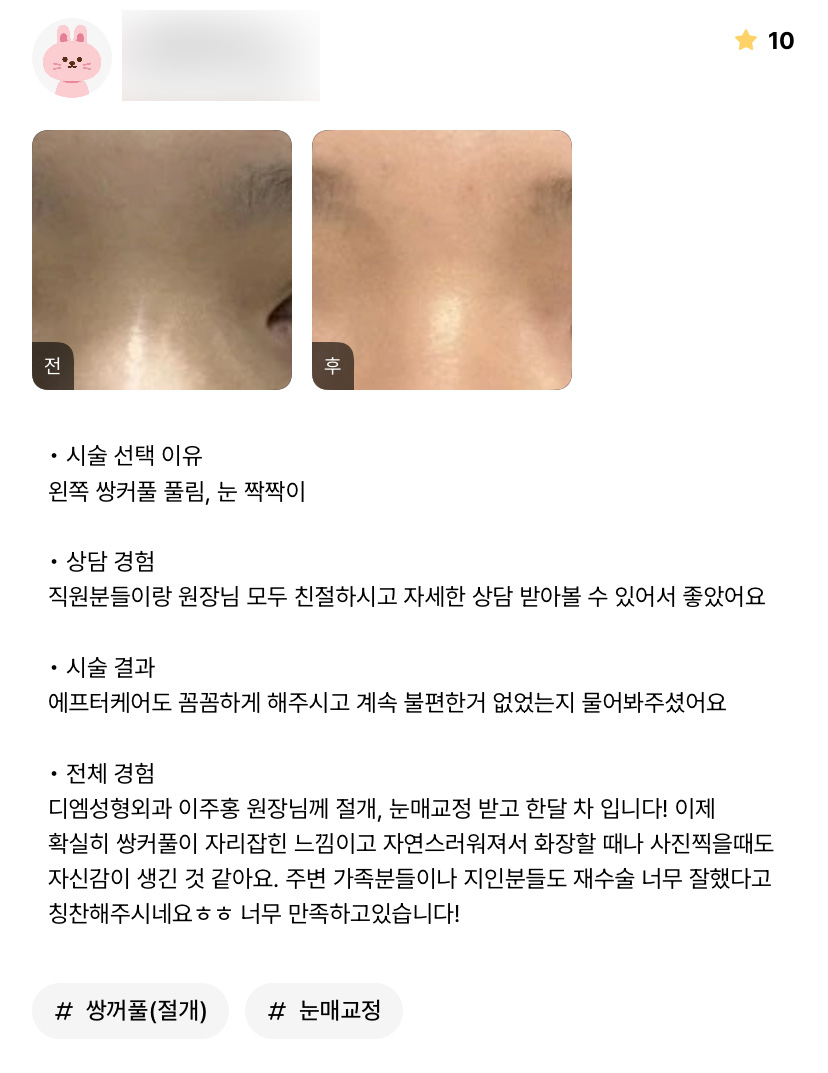 Revision Eyelid Surgery Review: “Now that it looks more natural, I feel more confident when putting on makeup and taking photos!” image 1