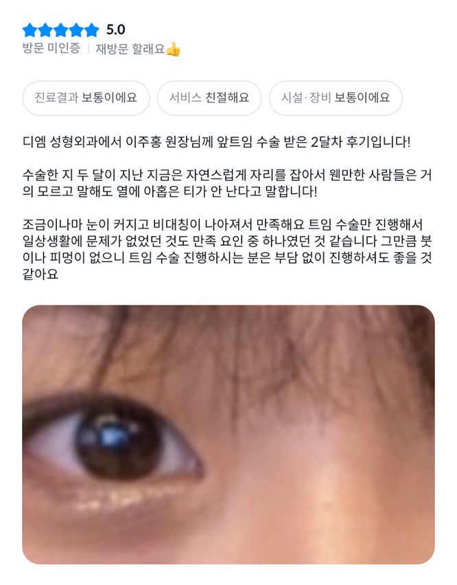 앞트임 후기."열에 아홉은 티가 안난대요 ! " 관련 이미지 1