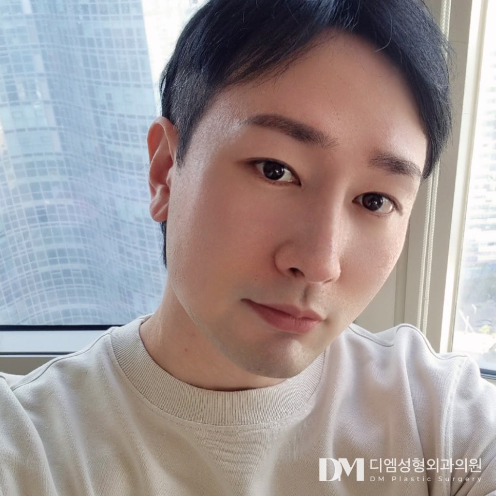 복코성형 , 얼굴의 균형과 조화를 맞춰 관련 이미지 14