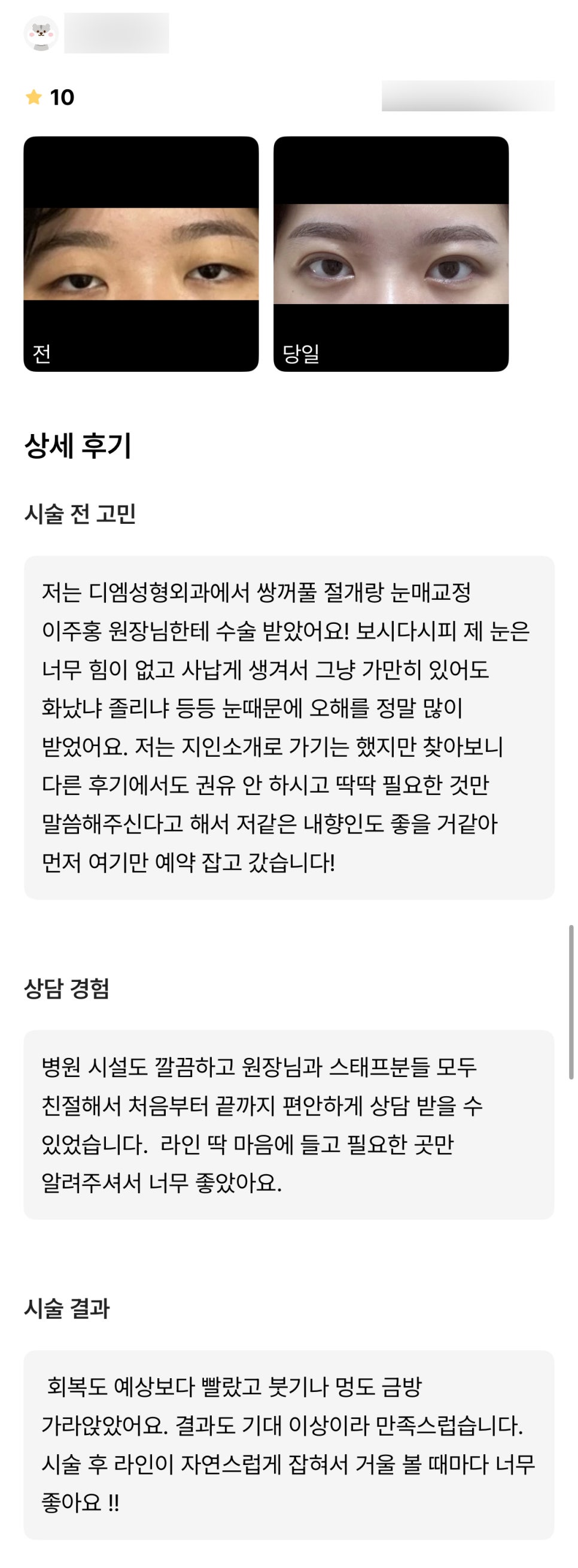 눈성형 후기."시술 후 라인이 자연스럽게 잡혀서 거울 볼 때마다 너무 좋아요 !!" 관련 이미지 1